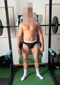 Fernando antes del proceso, con la cara pixelada