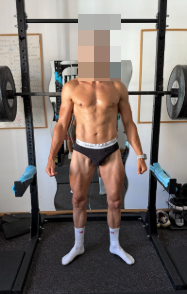Fernando después del proceso, con la cara pixelada