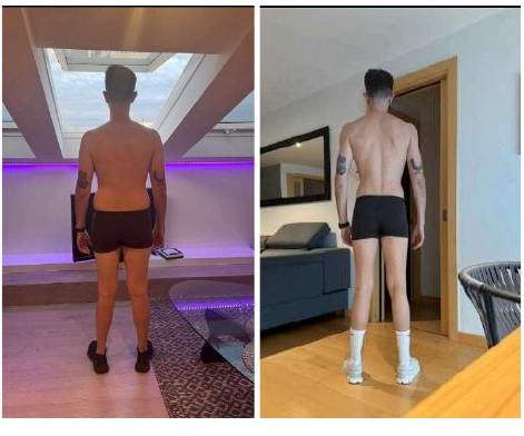 Comparativa de espalda de David durante su proceso